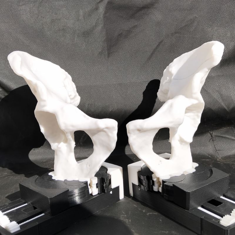 Pelvis armada — vista frontal